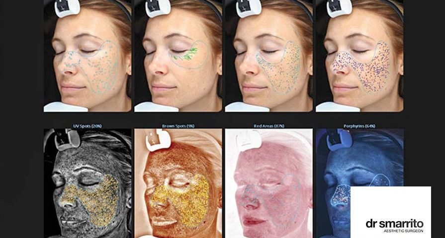 Une approche scientifique du diagnostic au niveau du visage en médecine esthétique