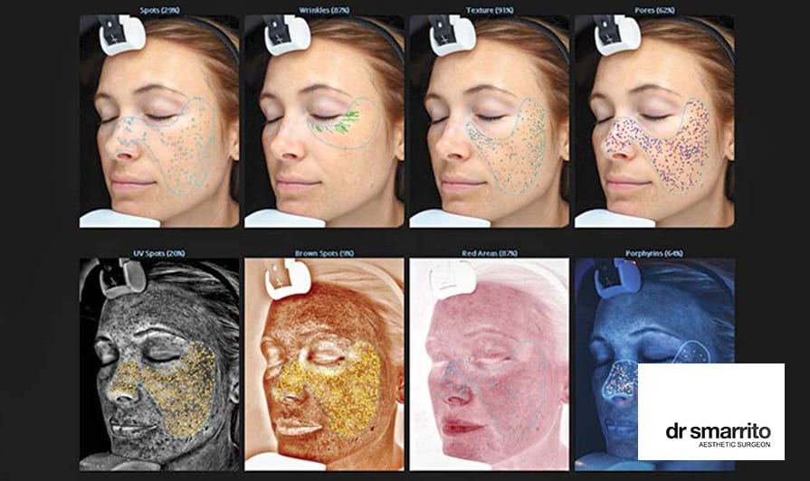 Une approche scientifique du diagnostic au niveau du visage en médecine esthétique
